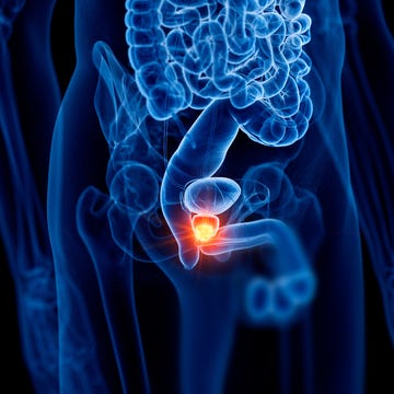 Medical illustration highlighting the prostate gland within the male anatomy.