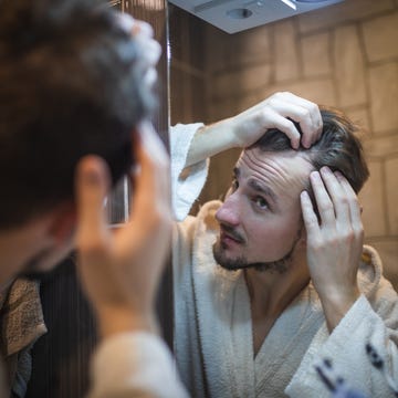 man checking hair line